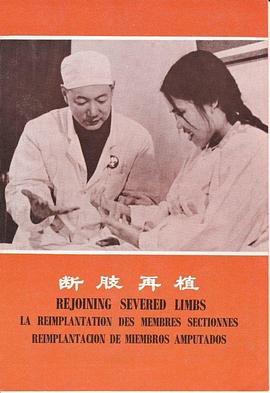 断肢再植